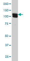HCAP-G monoclonal antibody (M01), clone 4B1 Western blot of HCAP-G expression in HeLa.