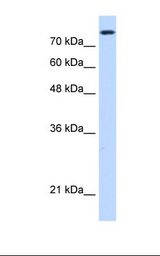 HepG2 cell lysate. Antibody concentration: 0.25 ug/ml. Gel concentration: 12%.