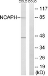 Western blot of extracts from COLO cells, using NCAPH Antibody. The lane on the right is treated with the synthesized peptide.