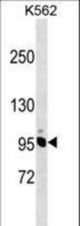 NCAPH Antibody western blot of K562 cell line lysates (35 ug/lane). The NCAPH antibody detected the NCAPH protein (arrow).