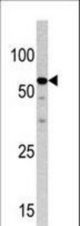 Western blot of anti-NCAPH2 antibody in HepG2 cell line lysate (35 ug/lane). NCAPH2(arrow) was detected using the purified antibody.