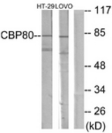 Western blot of extracts from HT-29/LOVO cells, using NCBP1 Antibody. The lane on the right is treated with the synthesized peptide.