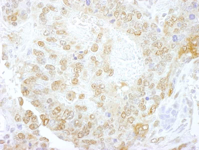 Detection of Mouse NCBP1/CBP80 by Immunohistochemistry. Sample: FFPE section of mouse teratoma. Antibody: Affinity purified rabbit anti-NCBP1/CBP80 used at a dilution of 1:250.