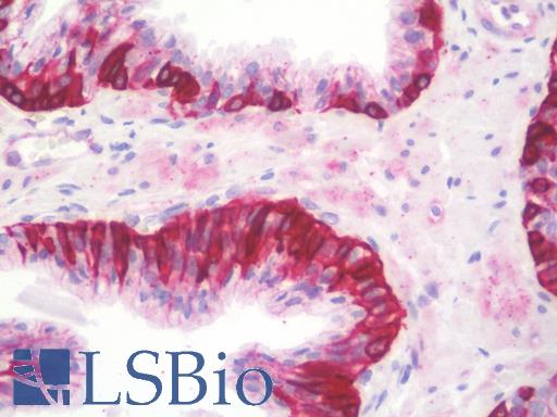 Anti-NCBP1 / CBP80 antibody IHC staining of human prostate. Immunohistochemistry of formalin-fixed, paraffin-embedded tissue after heat-induced antigen retrieval. Antibody LS-B10118 concentration 10 ug/ml.