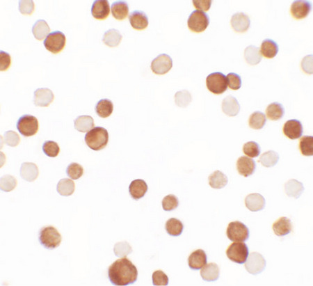 Immunocytochemistry of NCBP1 in HeLa cells with NCBP1 antibody at 2.5 ug/ml.