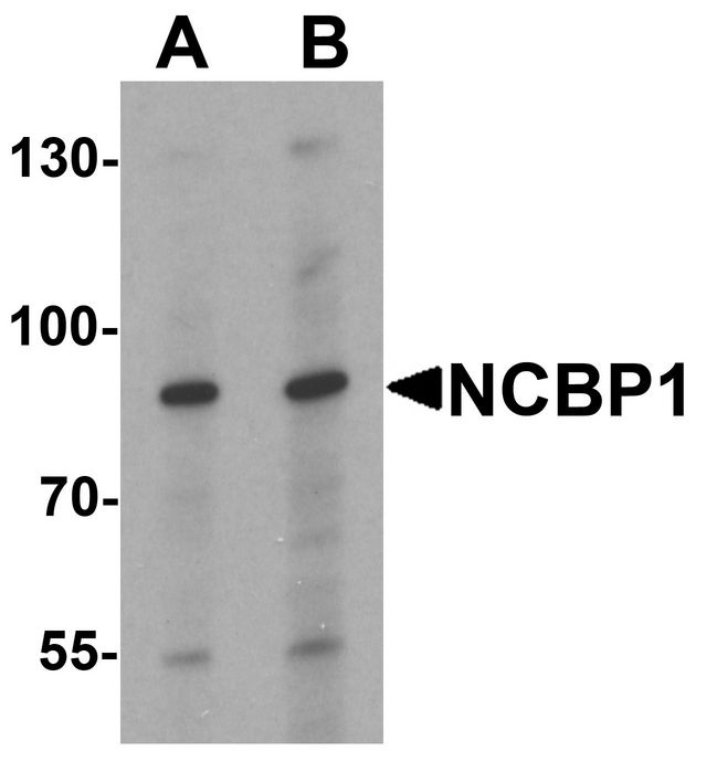 Western blot analysis of NCBP1 in HeLa cell lysate with NCBP1 antibody at (A) 1 and (B) 2 ug/ml.