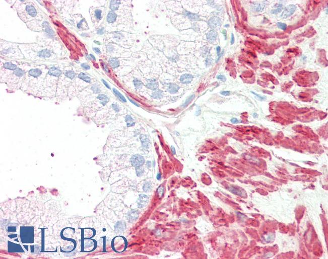Anti-MC5 Receptor antibody LS-A3805 IHC of human prostate. Immunohistochemistry of formalin-fixed, paraffin-embedded tissue after heat-induced antigen retrieval.