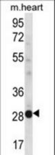 NCCRP1 Antibody western blot of mouse heart tissue lysates (35 ug/lane). The NCCRP1 antibody detected the NCCRP1 protein (arrow).