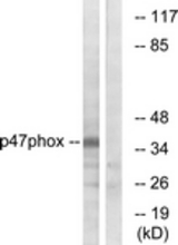 Western blot of extracts from HeLa cells, treated with TSA 400 ng/ml 24h, using p47 phox (Ab-359) Antibody. The lane on the right is treated with the synthesized peptide.