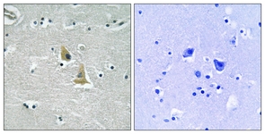 IHC of paraffin-embedded human brain tissue, using p47 phox (Ab-345) Antibody. The picture on the right is treated with the synthesized peptide.