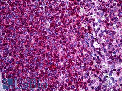 Anti-p47phox antibody IHC of human spleen. Immunohistochemistry of formalin-fixed, paraffin-embedded tissue after heat-induced antigen retrieval. Antibody LS-B5698 concentration 5 ug/ml.