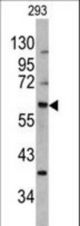 Western blot of MDM2 antibody (S166) in 293 cell line lysates (35 ug/lane). MDM2 (arrow) was detected using the purified antibody.