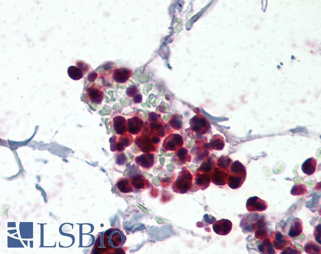 Anti-p47phox antibody IHC of human colon, neutrophils. Immunohistochemistry of formalin-fixed, paraffin-embedded tissue after heat-induced antigen retrieval. Antibody LS-B2365 concentration 5 ug/ml.