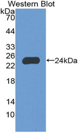 Western blot of recombinant NCF2 / NOXA2 / p67phox.