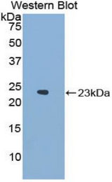 Western blot of recombinant NCF2 / NOXA2 / p67phox.