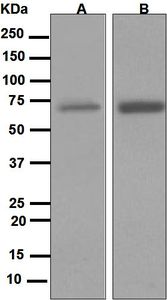 Western blot analysis on (A) THP-1 and (B) HL-60 treated with Dexomethasone and TPA cell lysates using anti-p67 / phox antibody.