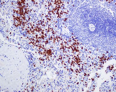 IHC of paraffin-embedded human spleen tissue using anti-p67phox / NCF2 antibody.