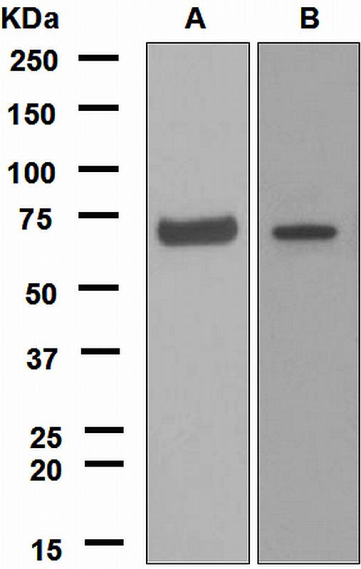 Western blot analysis on (A) HL-60 treated with Dexamethasone, dimethyl sulfoxide, and TPA, (B) THP-1 cell lysates using anti-p67phox / NCF2 antibody.
