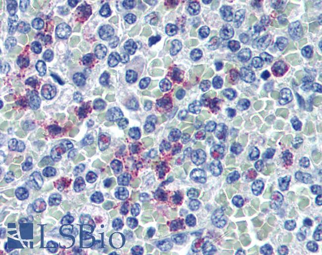 Anti-NCF2 / p67phox antibody IHC of human spleen, neutrophils. Immunohistochemistry of formalin-fixed, paraffin-embedded tissue after heat-induced antigen retrieval. Antibody LS-B2171 concentration 5 ug/ml.