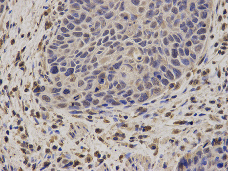 Immunohistochemistry of paraffin-embedded human esophagus using NCF2 antibody at dilution of 1:100 (400x lens).