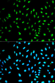 Immunofluorescence analysis of HeLa cell using NCF2 antibody. Blue: DAPI for nuclear staining.