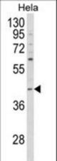 Western blot of NCK1 Antibody in HeLa cell line lysates (35 ug/lane). NCK1 (arrow) was detected using the purified antibody.