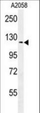 NCKAP1 Antibody western blot of A2058 cell line lysates (35 ug/lane). The NCKAP1 antibody detected the NCKAP1 protein (arrow).