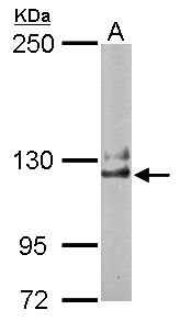 Sample (50 ug of whole cell lysate). A: Mouse brain. 5% SDS PAGE. NCKAP1 / NAP125 antibody diluted at 1:1000.