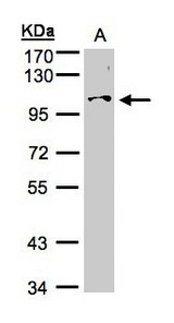 Sample (30g whole cell lysate). A: Hep G2 . 7.5% SDS PAGE. NCKAP1 / NAP125 antibody diluted at 1:500