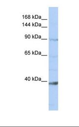 Jurkat cell lysate. Antibody concentration: 1.0 ug/ml. Gel concentration: 6-18%.