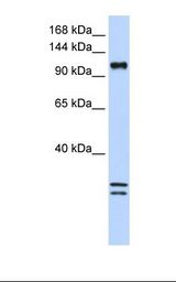 293T cell lysate. Antibody concentration: 1.0 ug/ml. Gel concentration: 6-18%.