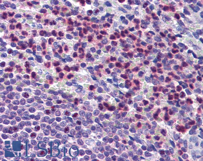 Anti-NCKAP1L antibody IHC of human spleen. Immunohistochemistry of formalin-fixed, paraffin-embedded tissue after heat-induced antigen retrieval. Antibody LS-B3817 concentration 3.75 ug/ml.