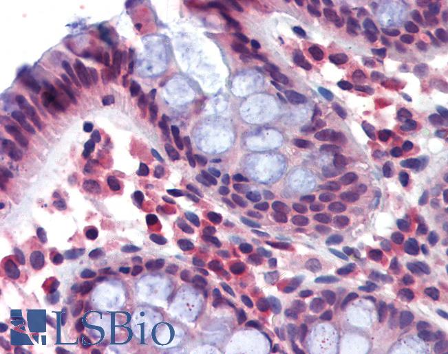 Anti-NCKAP1L antibody IHC of human colon. Immunohistochemistry of formalin-fixed, paraffin-embedded tissue after heat-induced antigen retrieval. Antibody LS-B3817 concentration 3.75 ug/ml.