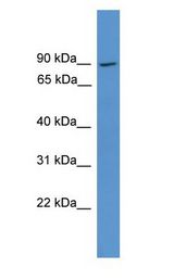 NCKIPSD / AF3P21 antibody Western Blot of Fetal Liver.