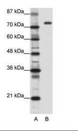 A: Marker, B: Daudi Cell Lysate