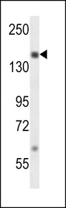 SRC1 Antibody western blot of MDA-MB231 cell line lysates (35 ug/lane). The SRC1 antibody detected the SRC1 protein (arrow).