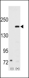 Western blot of SRC1 (arrow) using rabbit polyclonal SRC1 Antibody. 293 cell lysates (2 ug/lane) either nontransfected (Lane 1) or transiently transfected with the SRC1 gene (Lane 2) (Origene Technologies).