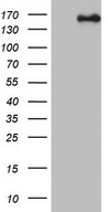 HEK293T cells were transfected with the pCMV6-ENTRY control (Left lane) or pCMV6-ENTRY NCOA2 (Right lane) cDNA for 48 hrs and lysed. Equivalent amounts of cell lysates (5 ug per lane) were separated by SDS-PAGE and immunoblotted with anti-NCOA2.