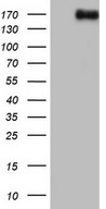 HEK293T cells were transfected with the pCMV6-ENTRY control (Left lane) or pCMV6-ENTRY NCOA2 (Right lane) cDNA for 48 hrs and lysed. Equivalent amounts of cell lysates (5 ug per lane) were separated by SDS-PAGE and immunoblotted with anti-NCOA2.