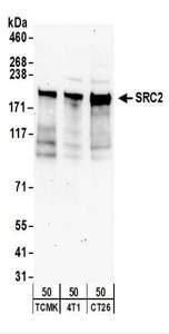 Detection of Mouse SRC2 by Western Blot. Samples: Whole cell lysate (50 ug) from TCMK-1, 4T1, and CT26.WT cells. Antibodies: Affinity purified rabbit anti-SRC2 antibody used for WB at 1 ug/ml. Detection: Chemiluminescence with an exposure time of 3 minutes.