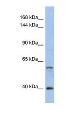 Western blot of Human HT1080. NCOA2 antibody dilution 1.0 ug/ml.