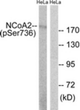 Western blot of extracts from HeLa cells treated with TSA 400nM 24H, using NCoA2 (Phospho-Ser736) Antibody. The lane on the right was incubated with synthetic peptide.