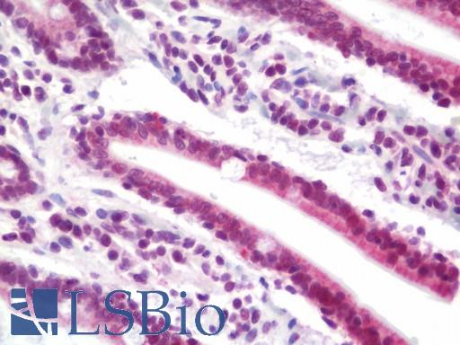 Anti-NCOA2 / TIF2 antibody IHC staining of human small intestine. Immunohistochemistry of formalin-fixed, paraffin-embedded tissue after heat-induced antigen retrieval.