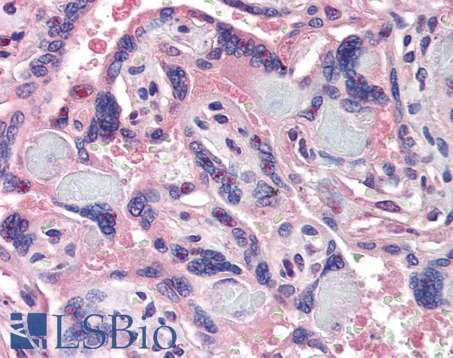 Anti-NCOA3 antibody IHC of human placenta. Immunohistochemistry of formalin-fixed, paraffin-embedded tissue after heat-induced antigen retrieval. Antibody LS-B3824 concentration 3.75 ug/ml.