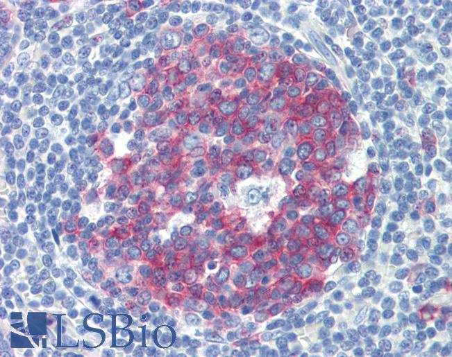 Anti-NCOA3 antibody IHC of human tonsil. Immunohistochemistry of formalin-fixed, paraffin-embedded tissue after heat-induced antigen retrieval. Antibody LS-B3493 concentration 5 ug/ml.