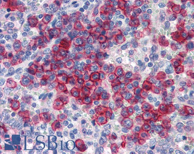 Anti-NCOA3 antibody IHC of human spleen. Immunohistochemistry of formalin-fixed, paraffin-embedded tissue after heat-induced antigen retrieval. Antibody LS-B3493 concentration 5 ug/ml.