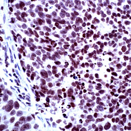Human brain stained with anti-SMRTe