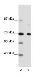 A: Marker, B: Hela Cell Lysate