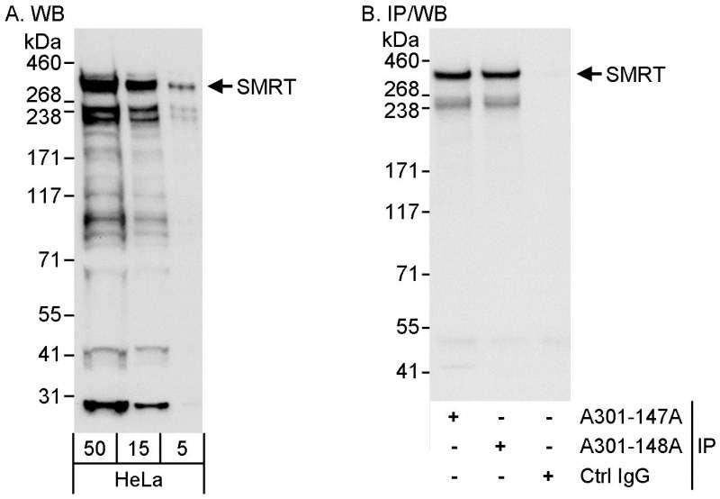 Detection of Human SMRT by Western Blot and Immunoprecipitation. Samples: Whole cell lysate (5, 15 and 50 ug for WB; 1 mg for IP, 20% of IP loaded) from HeLa cells. Antibodies: Affinity purified rabbit anti-SMRT antibody used for WB at 0.04 ug/ml (A) and 1.0 ug/ml (B) and used for IP at 3 ug/mg lysate. SMRT was also immunoprecipitated by rabbit anti-SMRT antibody A301-148, which recognizes a downstream epitope. Detection: Chemiluminescence with exposure times of 10 seconds (A) and 1 second (B).