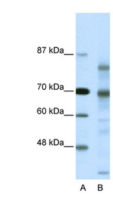 NCOR2 antibody LS-B1548 Western blot of HeLa lysate.